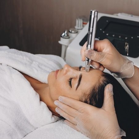 Transform Your Skin with Microneedling Treatment at Royal Clinic